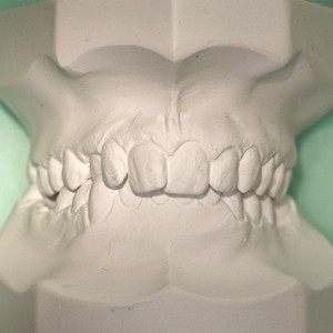 En quoi consiste le bilan orthodontique ?